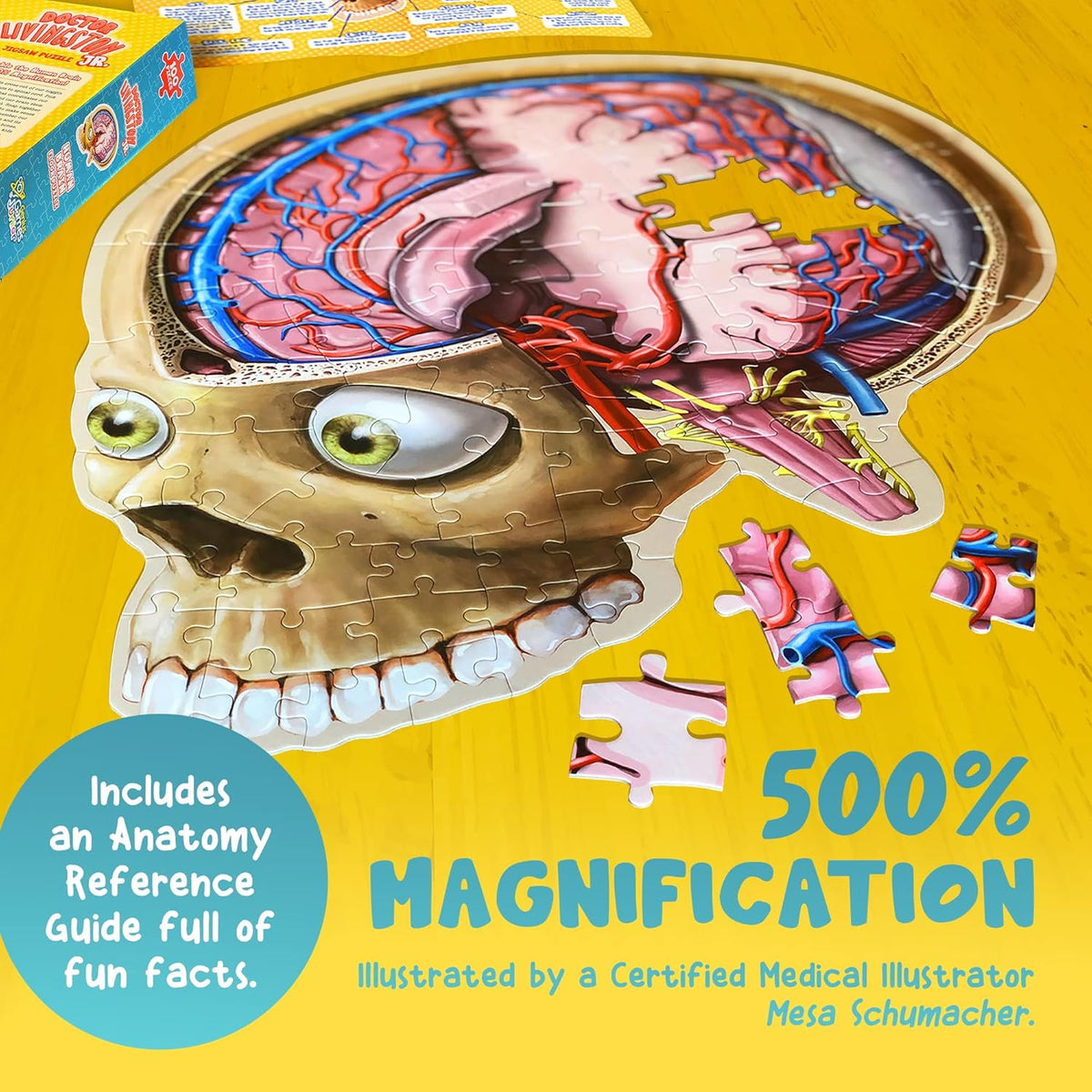 An anatomical jigsaw puzzle shows a partially completed human brain inside a skull, with detailed arteries and veins